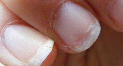 Fortalecé tus uñas quebradizas con estos sencillos trucos