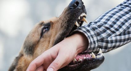 Qué hacer si te muerde un perro: los 5 pasos esenciales a seguir
